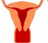 Normálna hrúbka endometria v menopauze a znaky vývoja hyperplázie endometria Aká je norma endometria v menopauze