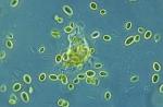 Hábitat de la ameba común